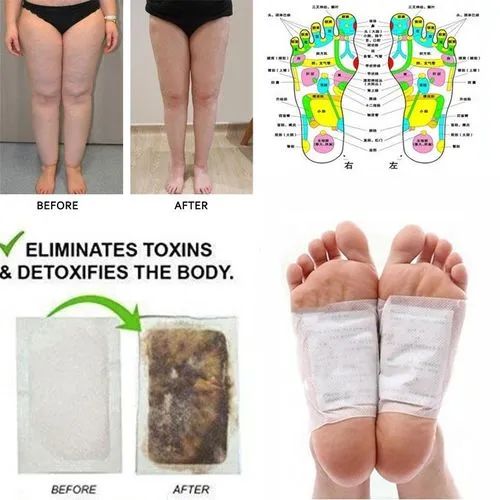 Kinoki Cleansing Detox Foot Pads (10 Pcs) – Original Organic Herbal Foot Patch with Free Shipping